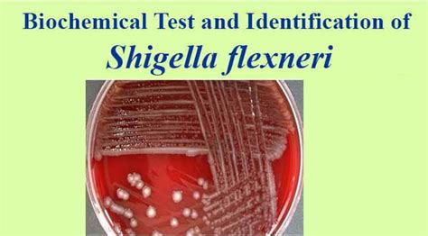 Biochemical Test and Identification of Shigella flexneri.